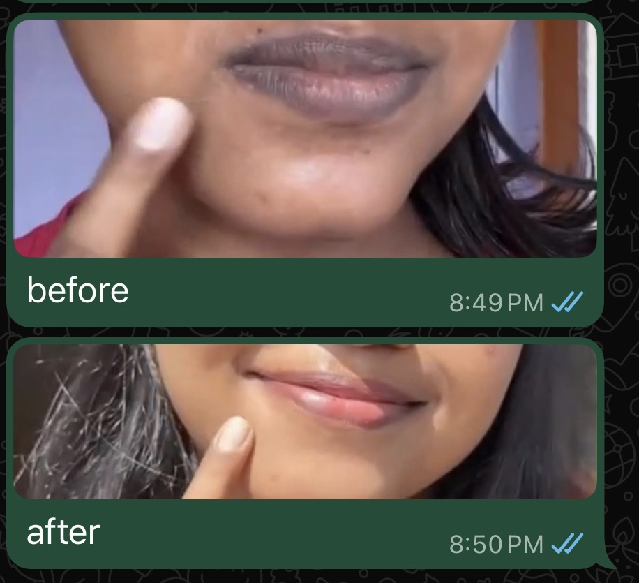 WhatsApp customer review showing before and after lip photos