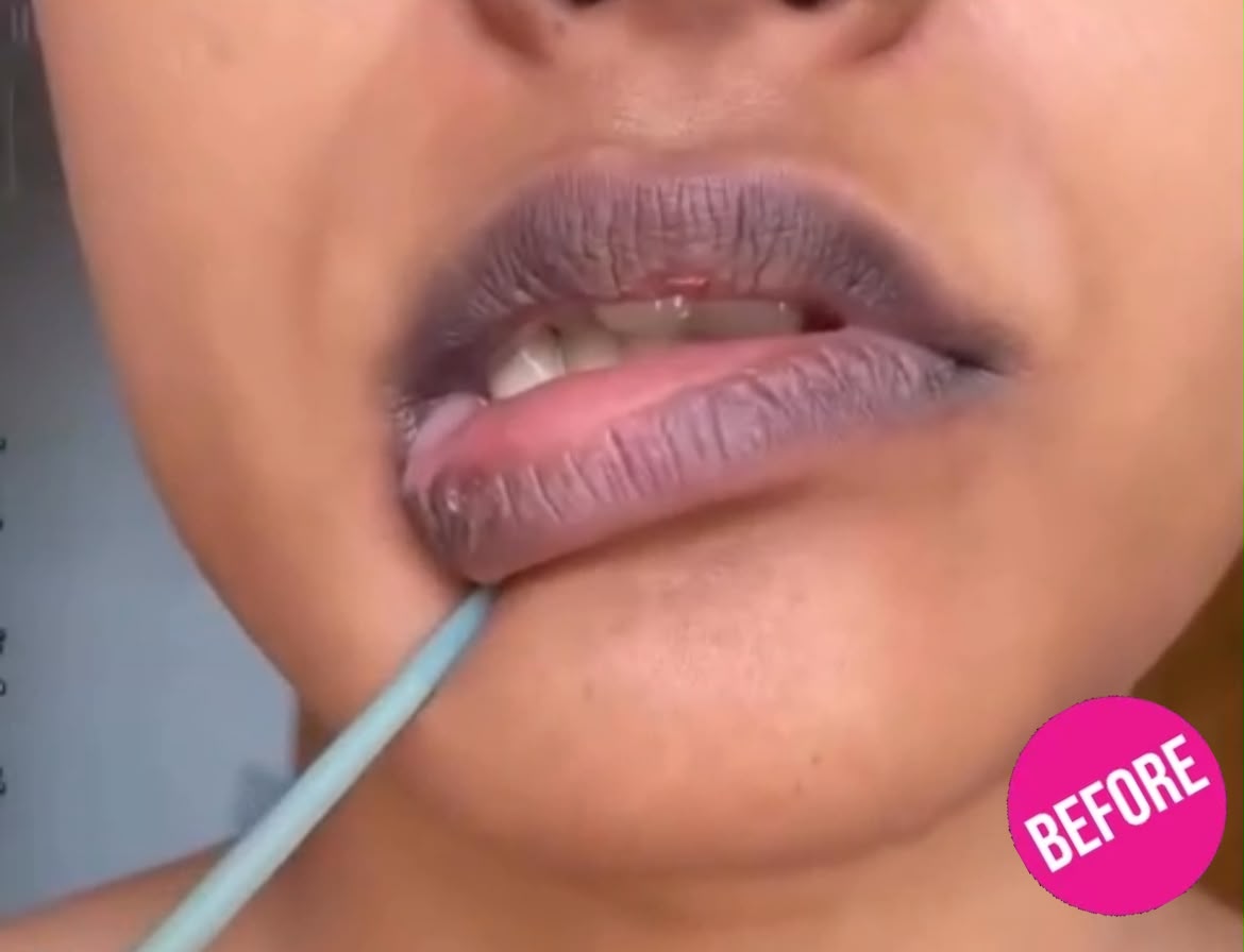 Customer lips before lip care routine