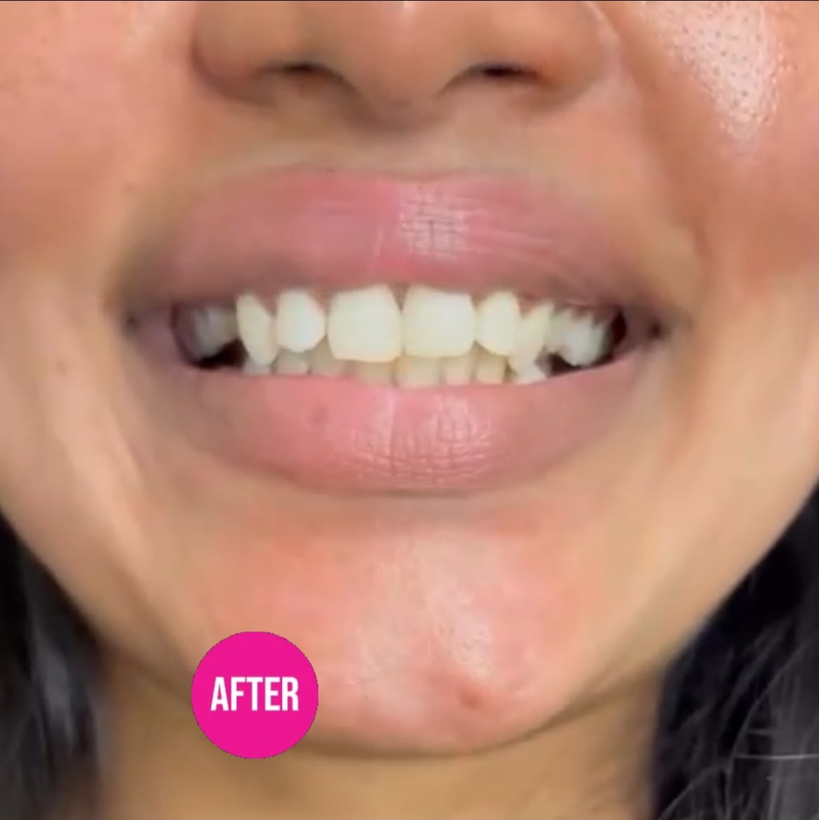 Real customer lips after using NICO RUB+