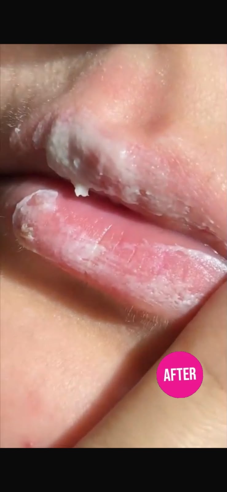 Customer lips after lip care routine