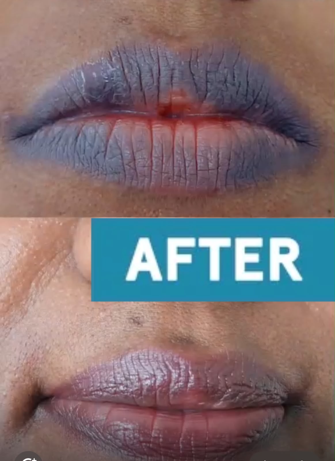 Customer lip care after photo